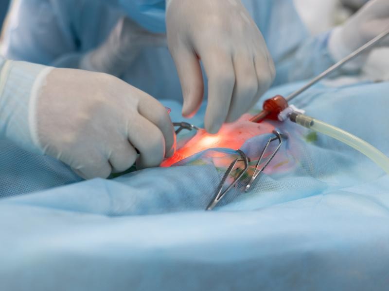 CIRURGIA DE COLUNA: QUANDO É NECESSÁRIA?