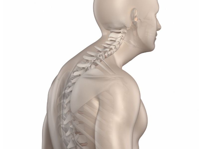 Cirurgia de Cifose de Scheuermann