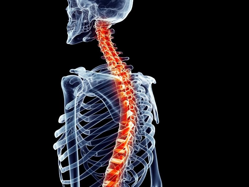 Cirurgia de Deformidades do Plano Sagital